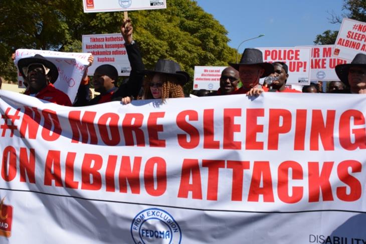 Malawi court hands death sentence for murderers of albino people.